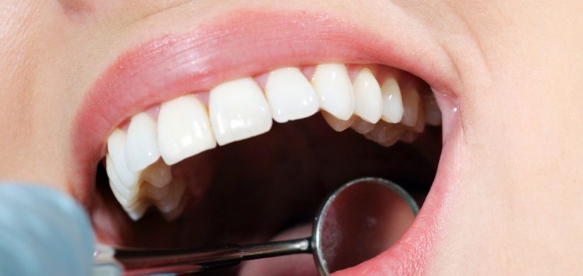 endodonzia-2_web